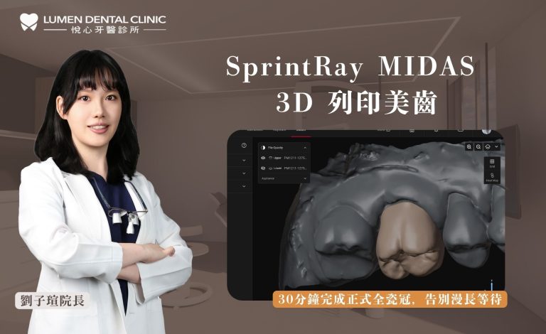 SprintRay MIDAS 3D 列印美齒