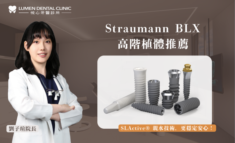 Straumann 高階植體推薦